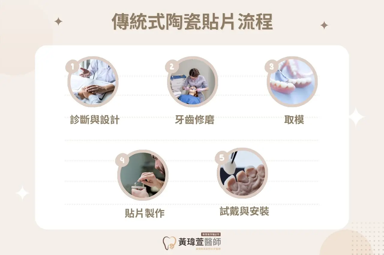 【陶瓷貼片價格費用解析】傳統v.s.數位式陶瓷貼片費用 3 傳統式陶瓷貼片流程