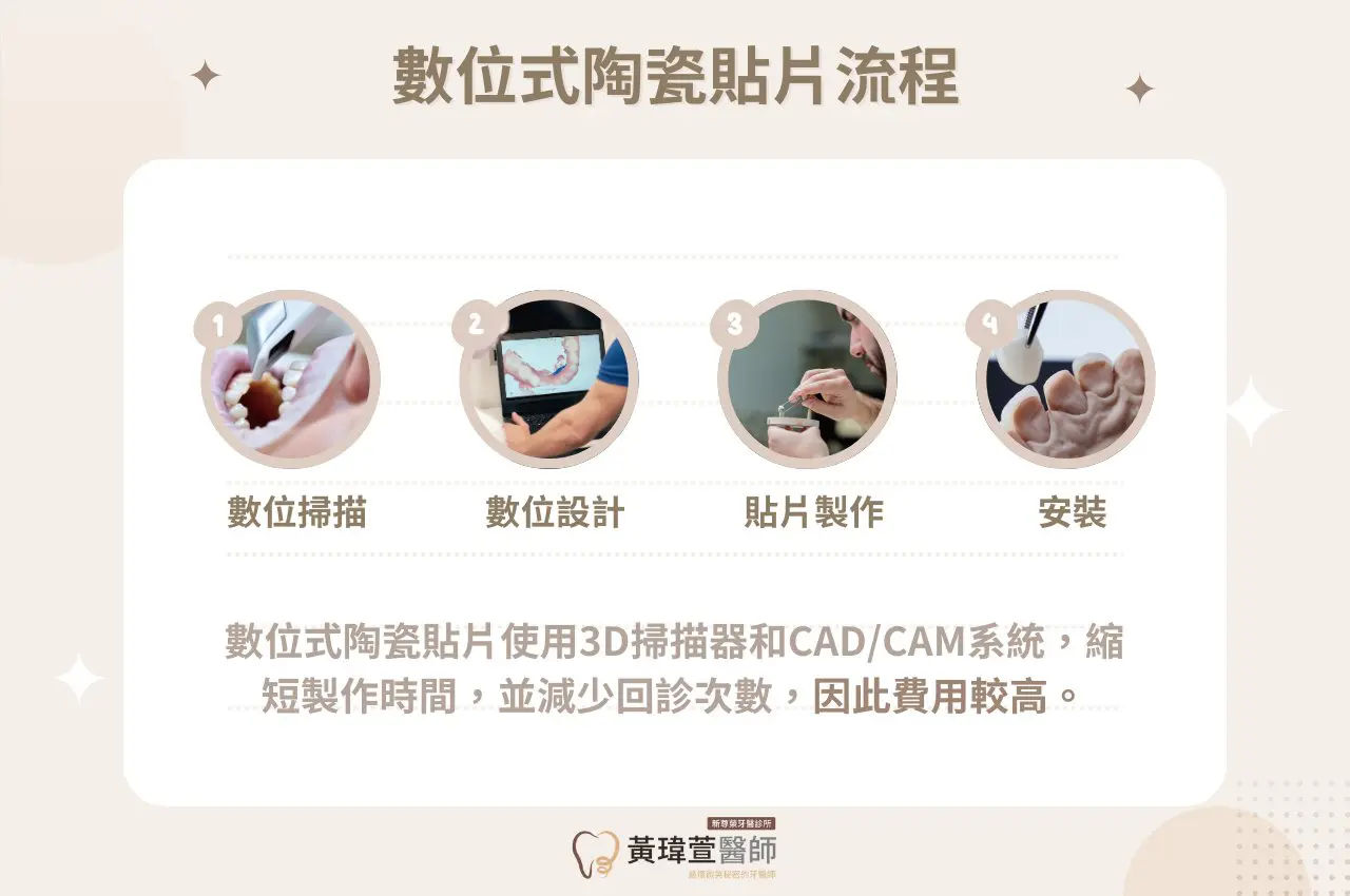 【陶瓷貼片價格費用解析】傳統v.s.數位式陶瓷貼片費用 4 數位式陶瓷貼片流程