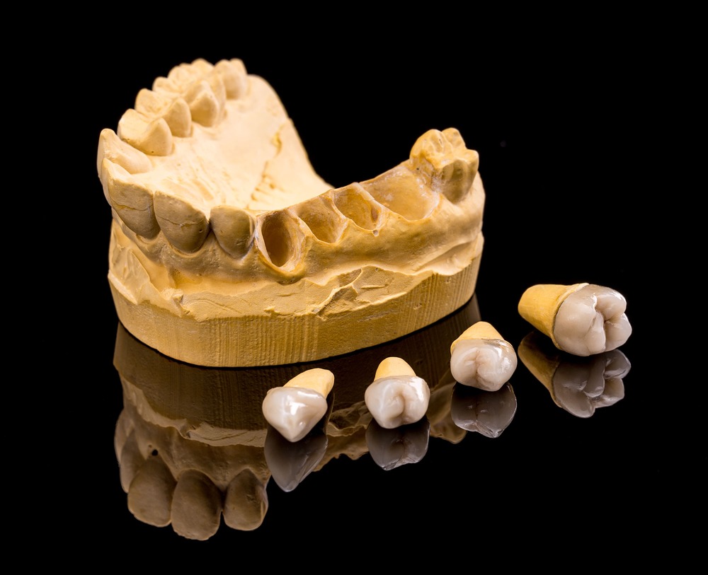 ceramic dental implants 2021 08 26 17 52 13 utc 1