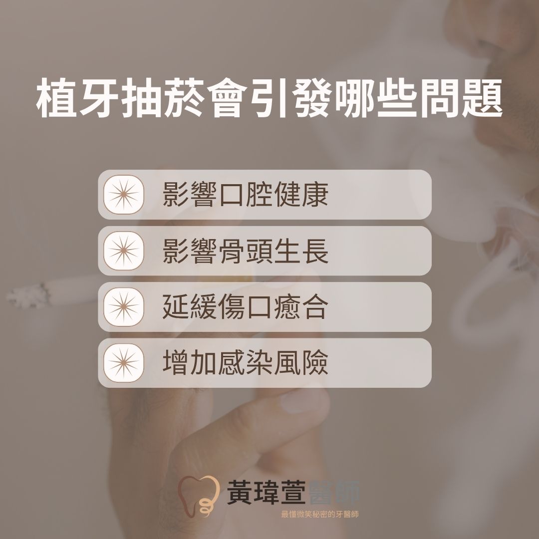 植牙抽菸很嚴重,醫:不僅僅是容易發炎而已 1 植牙抽菸會引發的4種問題