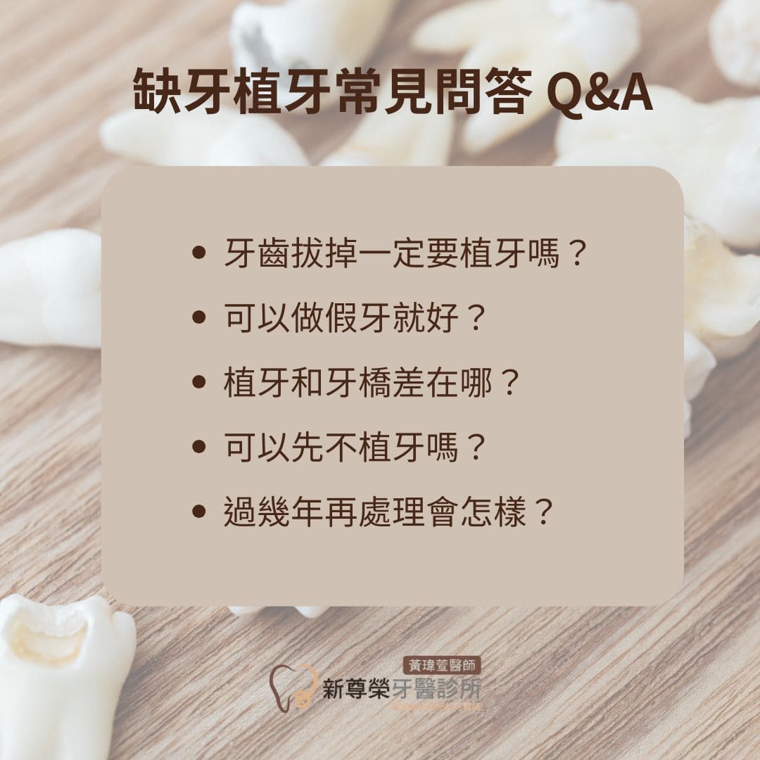 牙齒拔掉一定要植牙嗎?醫師解析不植牙的3種潛在風險與拔牙植牙替代方案 3 缺牙植牙常見問答