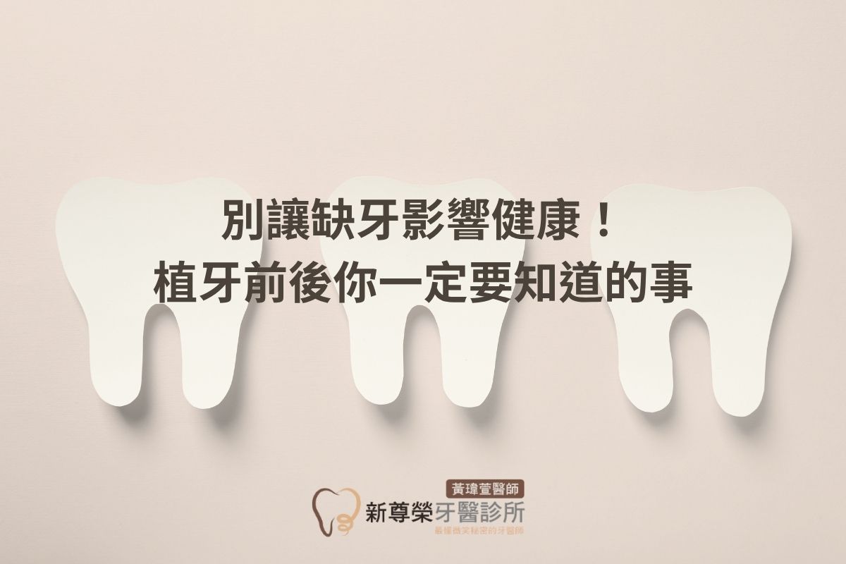 Read more about the article 別讓缺牙影響健康！植牙前後你一定要知道的事