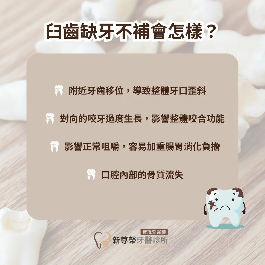 臼齒缺牙不補會怎樣？